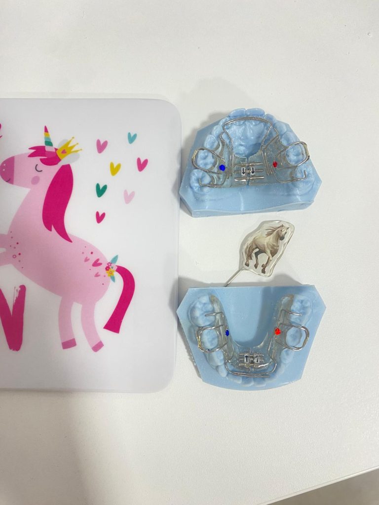 Aparat ortodontyczny dla dzieci – jednorożec Kolorowy aparat ortodontyczny dla dzieci z motywem jednorożca